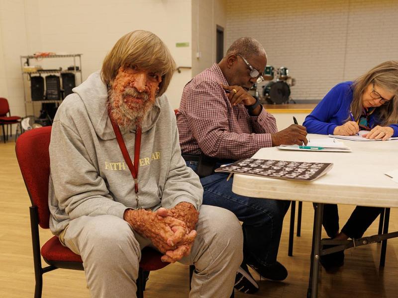 Tulsans living with tumors, rare disorder want to erase stigma