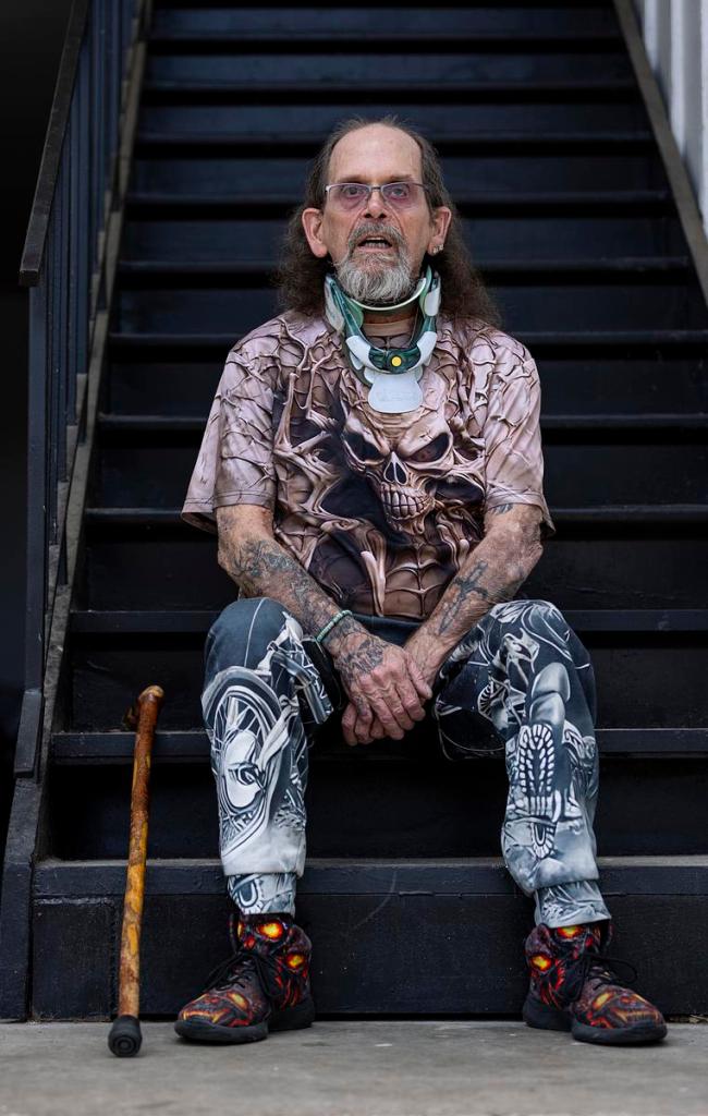 Mike O'Dell is pictured outside his Tulsa home May 14, 2026. He is living with Neurofibromatosis 1 (NF1), a condition that has led him to have 300 internal and external tumors removed.