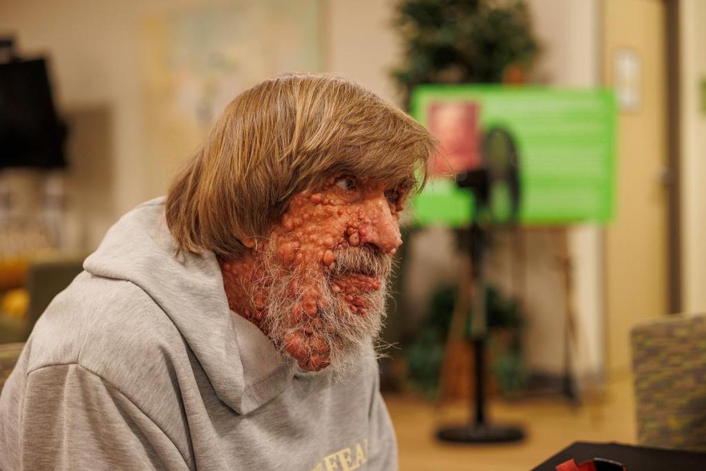 Gary Burke joins in a storytelling class at LIFE Senior Services' Roma Berry Senior Center on Wedesday, April 29, 2026. The 68-year-old was diagnosed with Neurofibromatosis 1 (NF1) when he was 13.